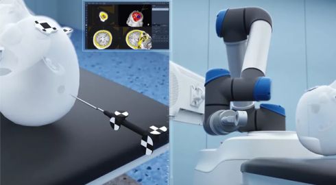 医療ロボット分野がスリップリングメーカーの注目に値する理由
